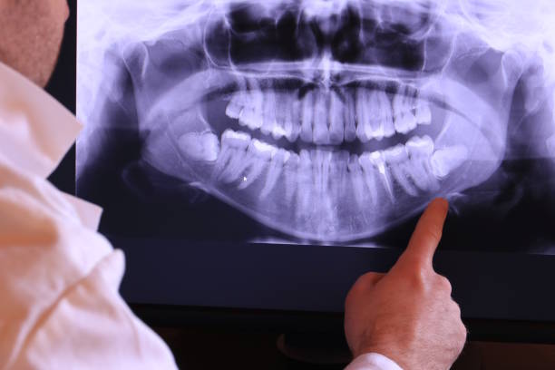 Best Broken Tooth Emergency  in Paw Paw Lake, MI