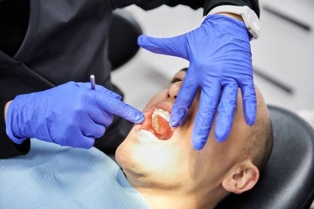 Best Teeth Whitening  in Paw Paw Lake, MI