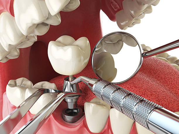 Best Emergency Gum Pain Relief  in Paw Paw Lake, MI